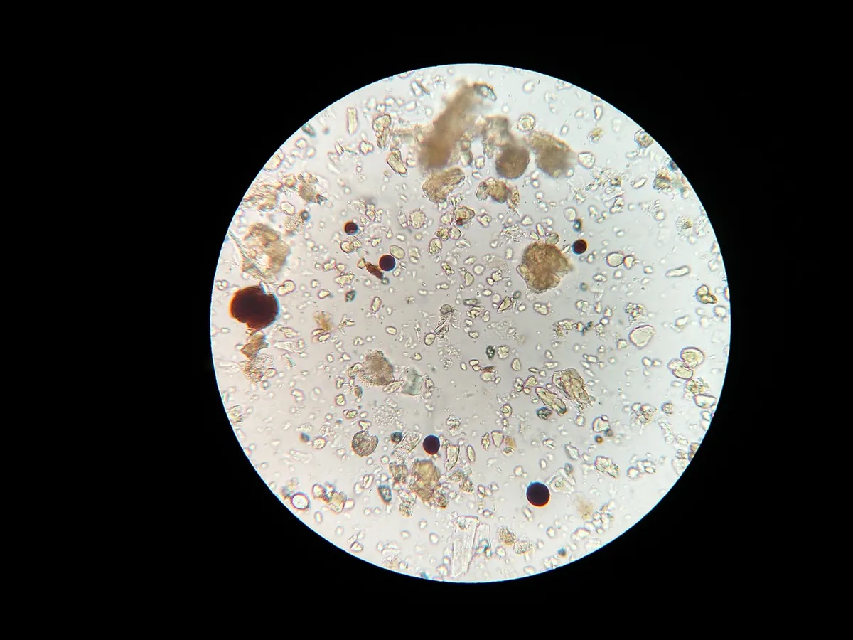 soil microbes, microscope, soil sample, soil microbes, soil microbes, soil microbes, microscope, microscope, microscope, microscope, microscope, soil sample